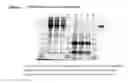 Fig. 07 - Isolation and Purification of Antibodies Using Protein A Affinity Chromatography