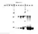 Fig. 09 - Binding inhibitor between TCTP dimer type IGE-dependent histamine releasing factor and receptor thereof, and use thereof