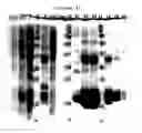 Fig. 10 - Binding inhibitor between TCTP dimer type IGE-dependent histamine releasing factor and receptor thereof, and use thereof