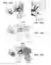 Fig. 17 - Anti-FGFR3 antibodies and methods using same