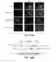 Fig. 31 - Anti-FGFR3 antibodies and methods using same