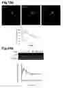 Fig. 20 - Generation of neural stem cells from human trophoblast stem cells