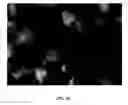 Fig. 25 - Reprogramming of cells to a new fate