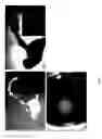 Fig. 02 - METHOD FOR PRODUCING TISSUE AND ORGAN