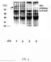Fig. 05 - Host cells for use in an inducible coexpression system