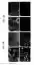 Fig. 12 - Endothelial-targeted Adenoviral Vectors, Methods and Uses Therefor