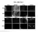 Fig. 15 - Endothelial-targeted Adenoviral Vectors, Methods and Uses Therefor