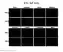 Fig. 16 - Endothelial-targeted Adenoviral Vectors, Methods and Uses Therefor