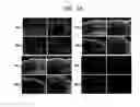 Fig. 18 - Endothelial-targeted Adenoviral Vectors, Methods and Uses Therefor