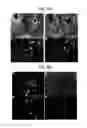 Fig. 21 - Endothelial-targeted Adenoviral Vectors, Methods and Uses Therefor