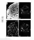 Fig. 23 - Endothelial-targeted Adenoviral Vectors, Methods and Uses Therefor