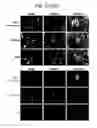 Fig. 48 - Endothelial-targeted Adenoviral Vectors, Methods and Uses Therefor
