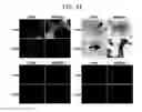 Fig. 53 - Endothelial-targeted Adenoviral Vectors, Methods and Uses Therefor