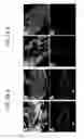 Fig. 54 - Endothelial-targeted Adenoviral Vectors, Methods and Uses Therefor