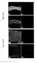 Fig. 56 - Endothelial-targeted Adenoviral Vectors, Methods and Uses Therefor