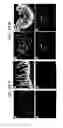 Fig. 58 - Endothelial-targeted Adenoviral Vectors, Methods and Uses Therefor