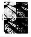 Fig. 59 - Endothelial-targeted Adenoviral Vectors, Methods and Uses Therefor