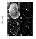 Fig. 62 - Endothelial-targeted Adenoviral Vectors, Methods and Uses Therefor