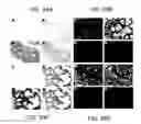 Fig. 65 - Endothelial-targeted Adenoviral Vectors, Methods and Uses Therefor