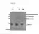 Fig. 11 - COMPOSITIONS AND METHOD FOR IDENTIFYING ENZYME AND TRANSPORT PROTEIN INHIBITORS