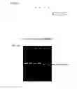 Fig. 11 - SINGLE MOLECULE NUCLEIC ACID SEQUENCING WITH MOLECULAR SENSOR COMPLEXES
