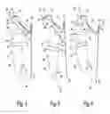 Fig. 07 - Laundry treating appliance with tub ring