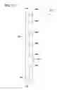 Fig. 18 - Wall anchor with hollow body