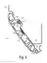 Fig. 04 - Impact-activated latch lock device, system, and method for glove box doors