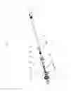 Fig. 04 - Spring operated roller blind system with tension spring adjusting mechanism and locking element for said system