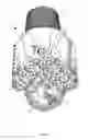 Fig. 02 - Tungsten carbide insert bit with milled steel teeth