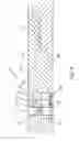 Fig. 06 - Downhole well system