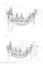 Fig. 02 - Yaw brake system