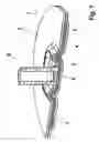 Fig. 02 - Device for anchoring at least one fastening element in a laminate structure having at least two layers
