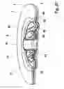 Fig. 28 - Device for anchoring at least one fastening element in a laminate structure having at least two layers