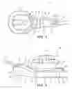 Fig. 04 - Cable tie assembly