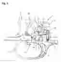 Fig. 05 - Gun lock and firearm having such a gun lock