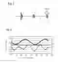 Fig. 05 - Fiber-optic sensor and method for the production and use thereof