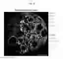 Fig. 04 - MULTIPLEX IMMUNOHISTOCHEMISTRY IMAGE CYTOMETRY