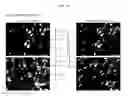 Fig. 05 - MULTIPLEX IMMUNOHISTOCHEMISTRY IMAGE CYTOMETRY