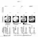 Fig. 16 - MULTIPLEX IMMUNOHISTOCHEMISTRY IMAGE CYTOMETRY