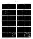 Fig. 28 - MULTIPLEX IMMUNOHISTOCHEMISTRY IMAGE CYTOMETRY