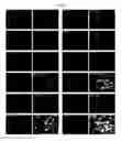 Fig. 29 - MULTIPLEX IMMUNOHISTOCHEMISTRY IMAGE CYTOMETRY