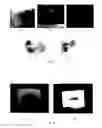 Fig. 05 - EMBEDDING MEDIUM FOR SPECIMEN PREPARATION, METHOD FOR PREPARING CURABLE BASE MATERIAL NONPENETRATING SPECIMEN, METHOD FOR PREPARING CURABLE BASE MATERIAL PENETRATING SPECIMEN, CURABLE BASE MATERIAL NONPENETRATING SPECIMEN, THIN SLICE PERFORMANCE IMPROVER FOR FROZEN EMBEDDING MEDIUM, AND FROZEN EMBEDDING MEDIUM