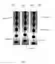 Fig. 04 - Flow rate balanced, dynamically adjustable sheath delivery system for flow cytometry