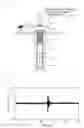 Fig. 02 - Non-destructive testing method and a non-destructive testing device for an anchor bolt