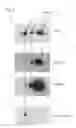 Fig. 03 - Method for the diagnosis of or risk for a disease mediated via the alternative pathway of the complement system