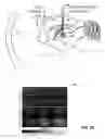 Fig. 04 - Optogenetic magnetic resonance imaging