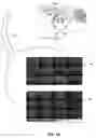 Fig. 06 - Optogenetic magnetic resonance imaging