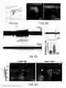 Fig. 09 - Optogenetic magnetic resonance imaging