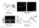 Fig. 10 - Optogenetic magnetic resonance imaging